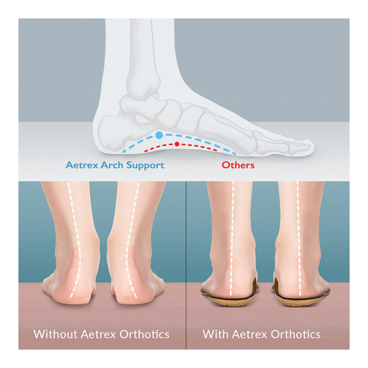 Comfort Features: Aetrex Signature Arch Support